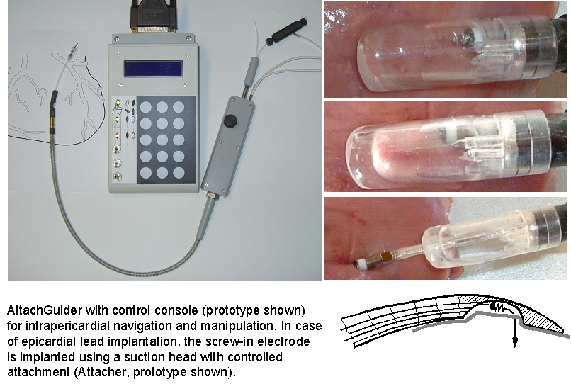 Attachguider
                        prototype