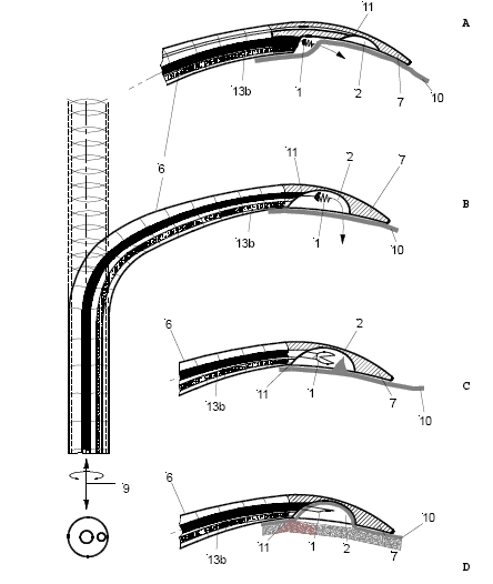 Attacher for
                        epicardial lead implantation