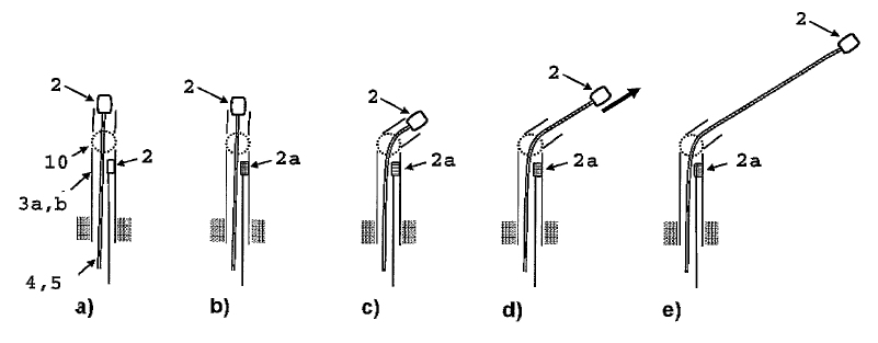 Attachguider
                          procedure 1