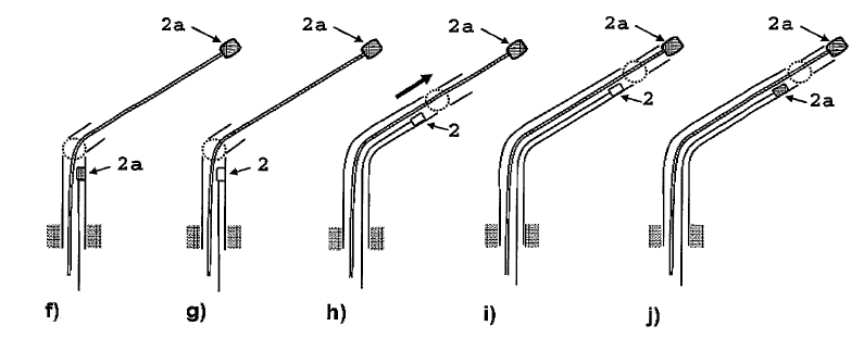 Attachguider
                          procedure 2