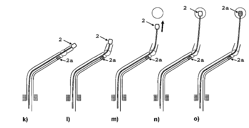 Attachguider
                          procedure 3